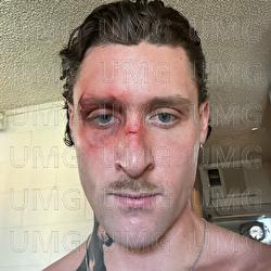 It Gets Better - KETTAMA